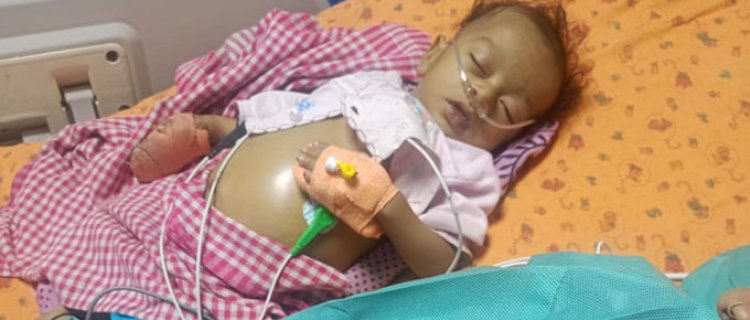 Chief Minister Dr. Mohan Yadav's Sensitivity and Swift Action Saved the Life of 5-Month-Old Lavyansh