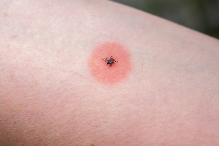 A Mysterious Illness Triggered by an Insect Bite Has Scientists Stumped
