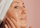 Melasma Treatment in Islamabad