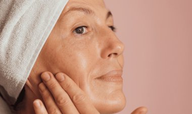 Melasma Treatment in Islamabad