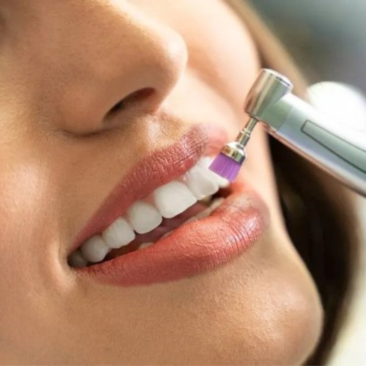 Teeth Scaling and Polishing in Islamabad: A Gentle Way to Clean Teeth