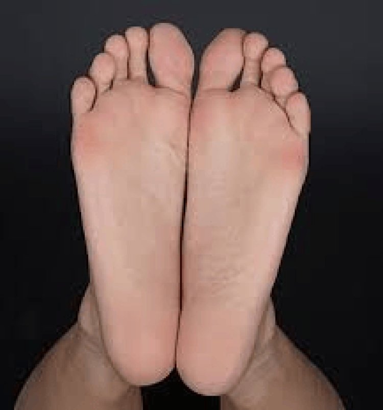 Causes of Blackened Skin on the Soles of Feet