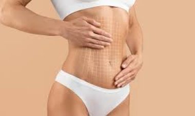 Vaser Liposuction in Dubai: What to Expect from Consultation to Results