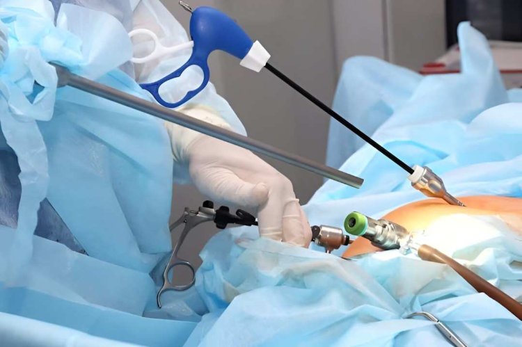 Trusted Laparoscopic Surgery in Islamabad