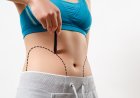 How Liposuction in Dubai Supports Safe and Precise Body Shaping
