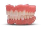 Dentures: Types, Benefits, Costs & Care Guide
