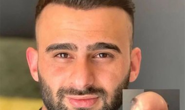 Hair Wig for Men for Confidence After Hair Loss