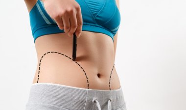 How Liposuction in Dubai Supports Safe and Precise Body Shaping
