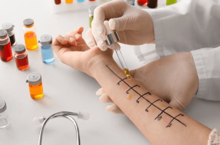 Choosing an Allergist Doctor Dubai for Allergy Relief