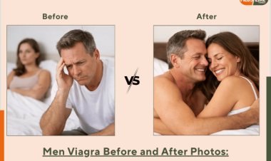 Men Viagra Before After Pictures | What to Expect from Treatment