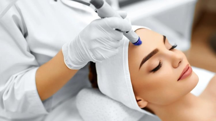 Microdermabrasion Treatment in Lauderdale Beach Benefits