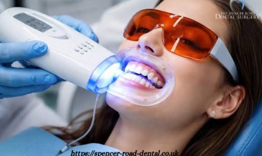 Why Teeth Whitening in Coventry: Safe, Effective Ways to Brighten Your Smile
