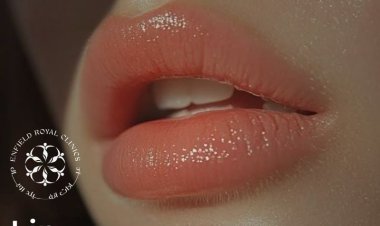 Lip Reduction Surgery Recovery Tips for Faster Healing and Better Results