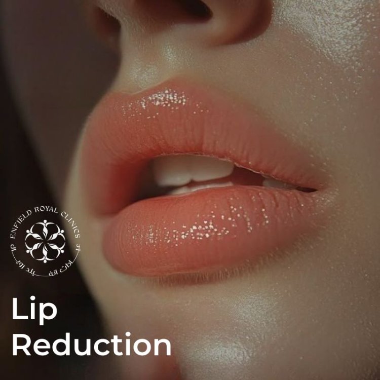 Lip Reduction Surgery Recovery Tips for Faster Healing and Better Results